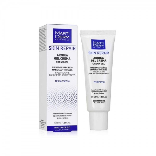martiderm arnika gel 30 ml